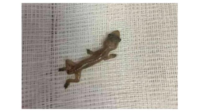 Dokter Ini Syok Temukan Hewan Hidup di Telinga Pasiennya