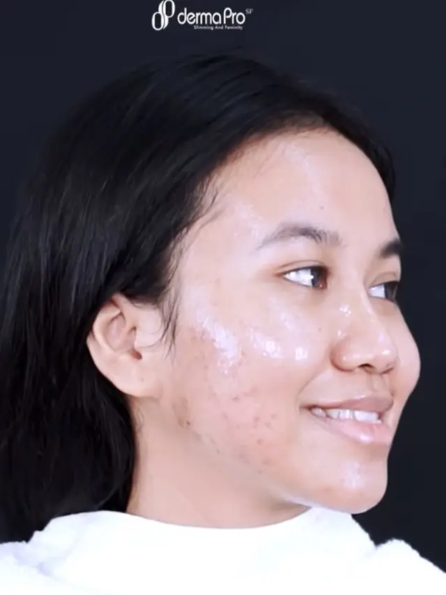 Makin Glow Up, Ini 6 Momen Mayang Perawatan Wajah Rp 80 Juta