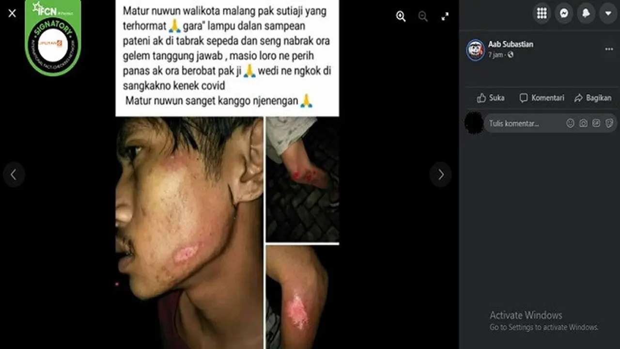 Gambar Tangkapan Layar Foto yang Diklaim Kecelakaan Akibat Pemadaman Lampu Jalan Selama PPKM Darurat di Malang (sumber: Facebook).