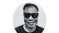 Temon Meninggal karena Serangan Jantung, Abdel Ucapkan Selamat Jalan