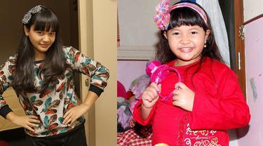 Masih Ingat Gadis Berponi Amel Carla Sekarang Makin Cantik Lho Lifestyle Fimela Com
