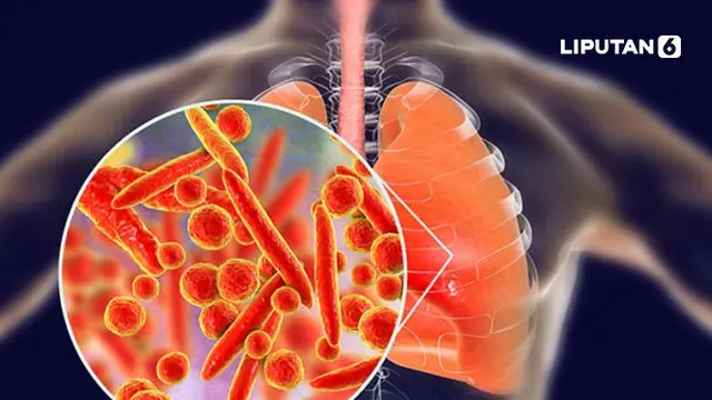 Banner Infografis Mycoplasma Pneumonia Merebak di China dan Eropa, Simak Gejala, Antisipasi, Mitigasi