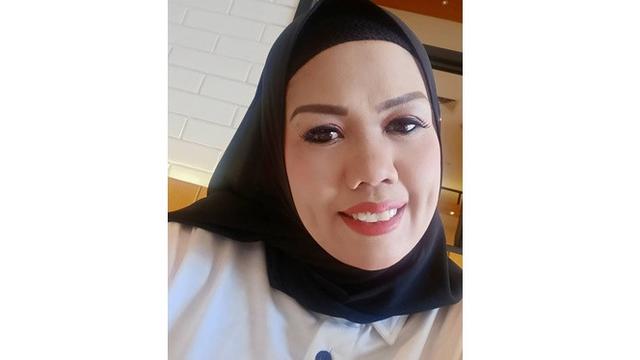 Lakukan Tanam Benang di Wajah, Ini 6 Potret Ely Sugigi Tampil Glowing