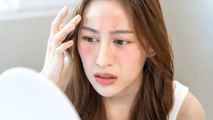 Tips Kembalikan Kesehatan Kulit Saat Mengalami Over-Exfoliating