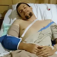 Kondisi terakhir Stuart Collin pasca menjalani operasi. (via instagram.com/agungbentuk)