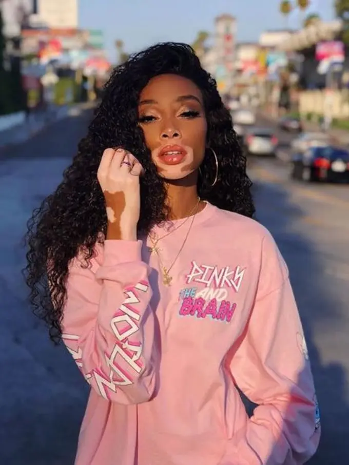 [Fimela] Perjalanan Panjang Winnie Harlow Sebelum Jadi Model Victoria’s Secret