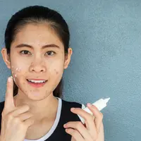 Ilustrasi memakai spot treatment jerawat/copyright shutterstock