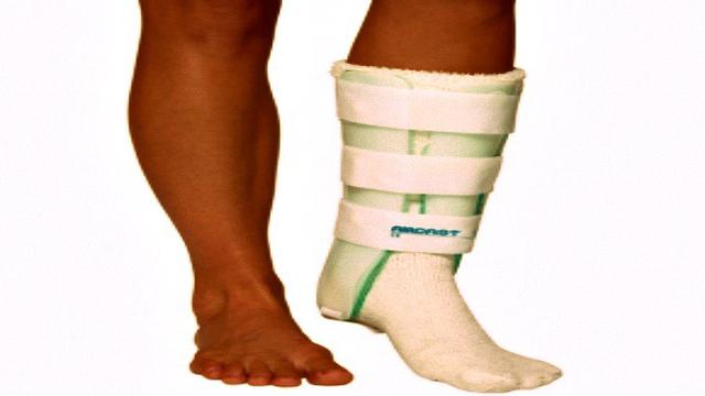 Cerita Dokter Tulang Terima Pasien dari Pengobatan 