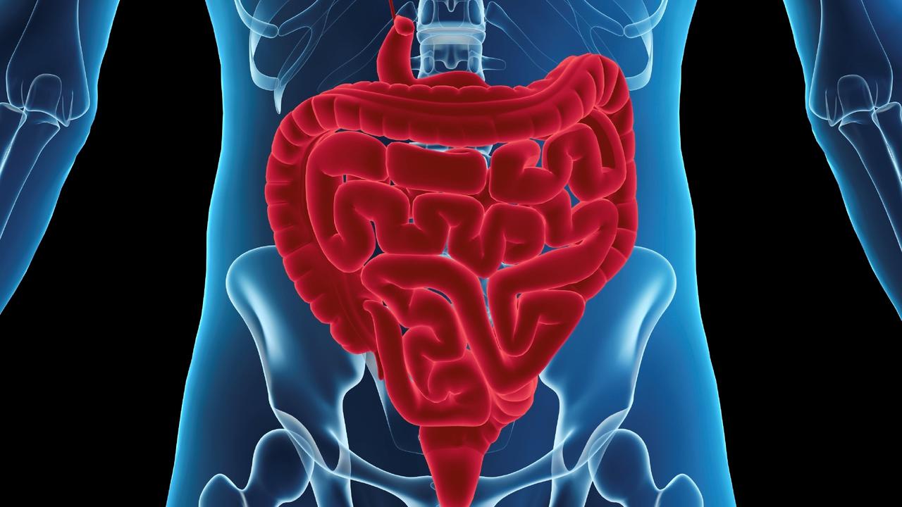 Penyebab dan Gejala Kanker Usus, Penyakit yang Diderita Komedian Nurul Qomar