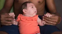 Wanita Hamil Dilarang ke 22 Negara Ini karena Virus Zika
