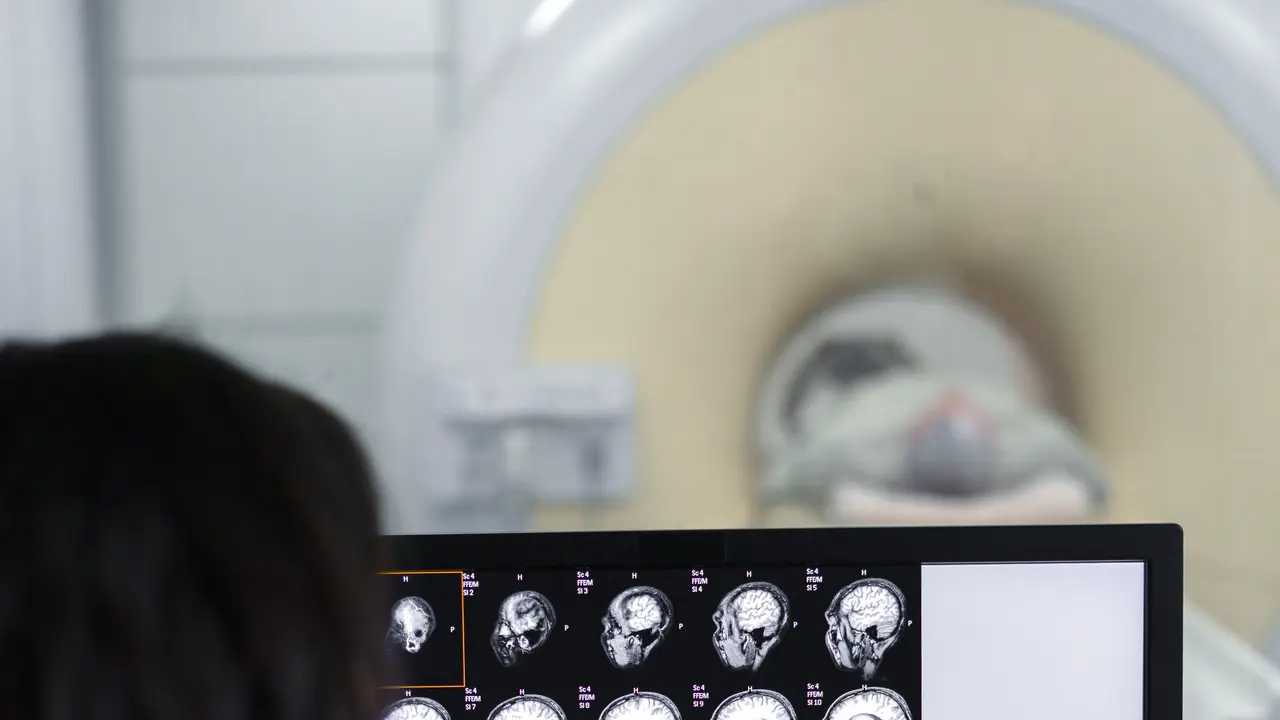 Ilustrasi dokter melihat ct scan pasien/freepik.com/jcomp