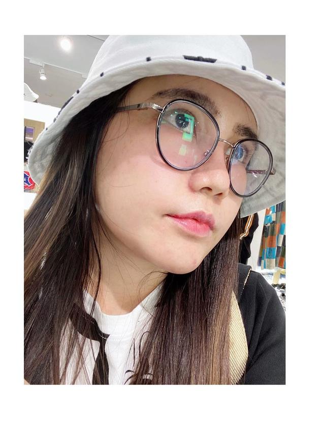 6 Potret Terbaru Via Vallen dengan Pipi Tembam, Makin Imut