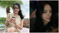 Habiskan Rp 521 Juta Untuk Oplas, Ini 6 Potret Terbaru Mawar AFI Bikin Pangling
