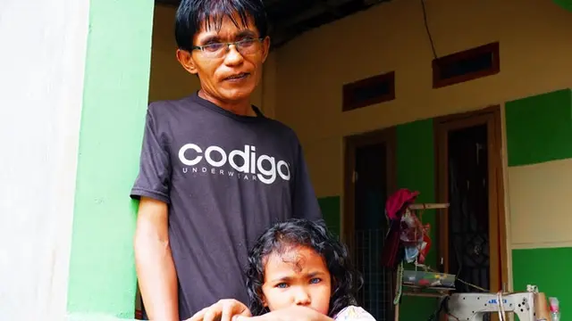 Anak bermata biru di Pekanbaru, Dzakira Azizy Naqiya bersama ayahnya Zulbahri yang juga punya mata biru.