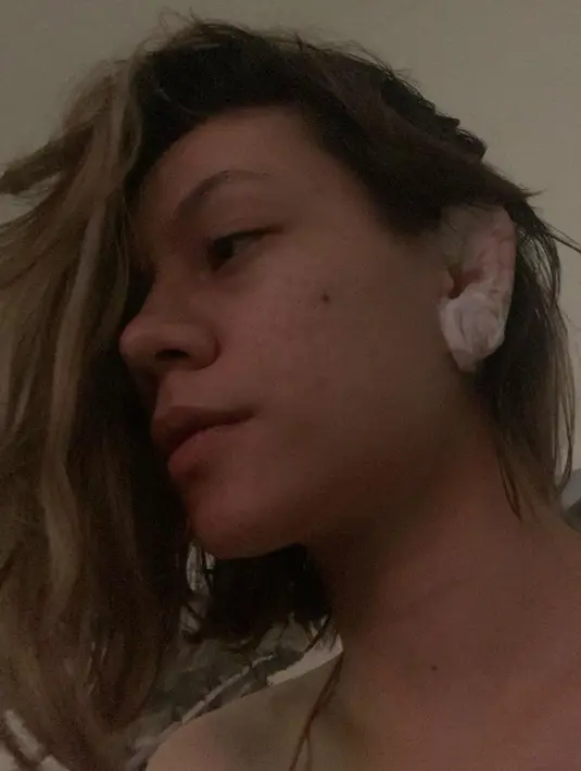 Di Instagram, ia mengungkap sempat dirawat di rumah sakit karena tumor. [Instagram/nonashe]