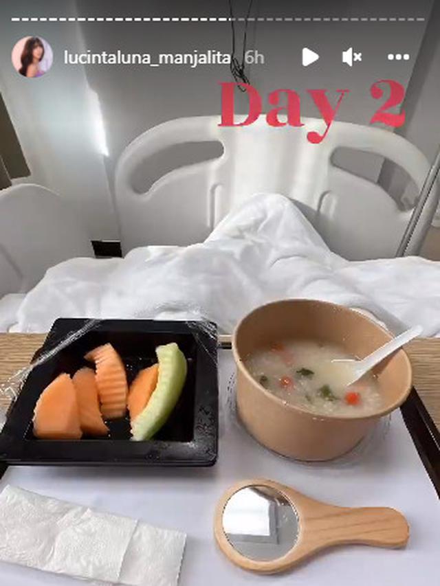 Lucinta Luna Diduga Lakukan Operasi Plastik, Ini 6 Potretnya dengan Wajah Diperban