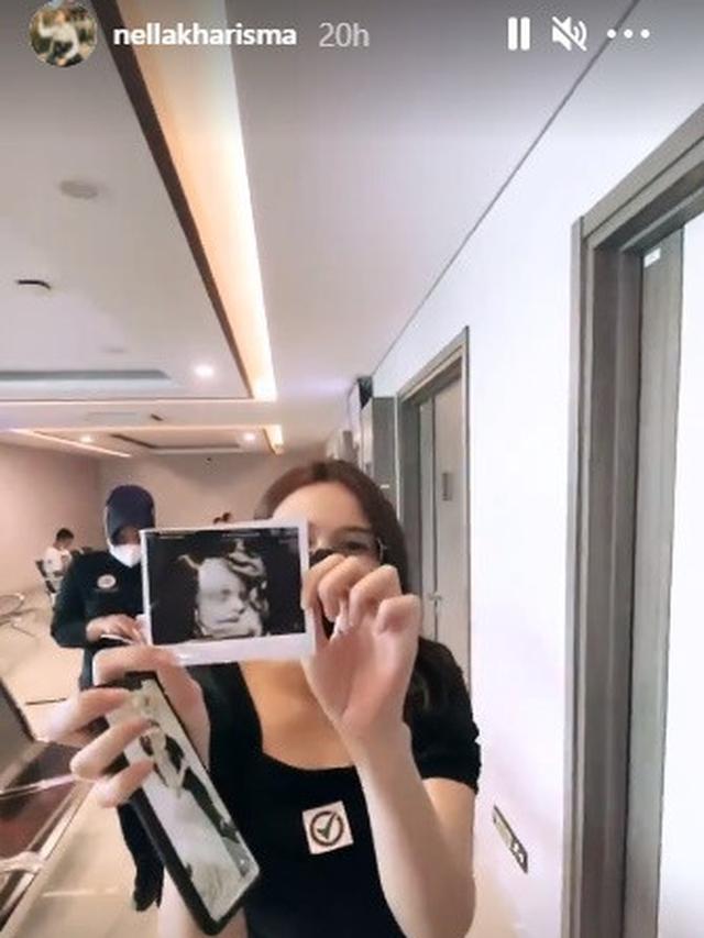 7 Momen Nella Kharisma Periksa Kandungan Bersama Dory Harsa, Pamerkan Hasil USG