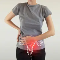 Ilustrasi kanker ovarium. Sumber foto: Shutterstock.