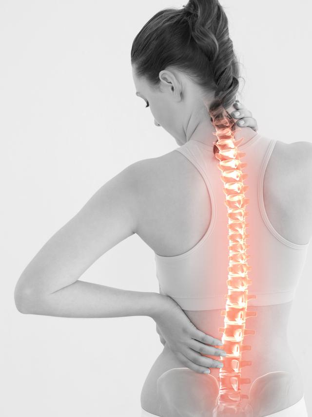 Jangan Anggap Remeh Skoliosis, Ini Langkah Pencegahan dan Penanganan Tepat