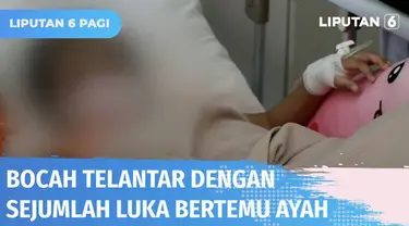 Setelah beredar luas di sosmed, bocah yang telantar di jalan dengan sejumlah luka akhirnya bertemu ayah kandungnya di RSUD Wangaya, Bali. Diduga bocah dianiaya sang ibu setelah berpisah dari ayahnya.