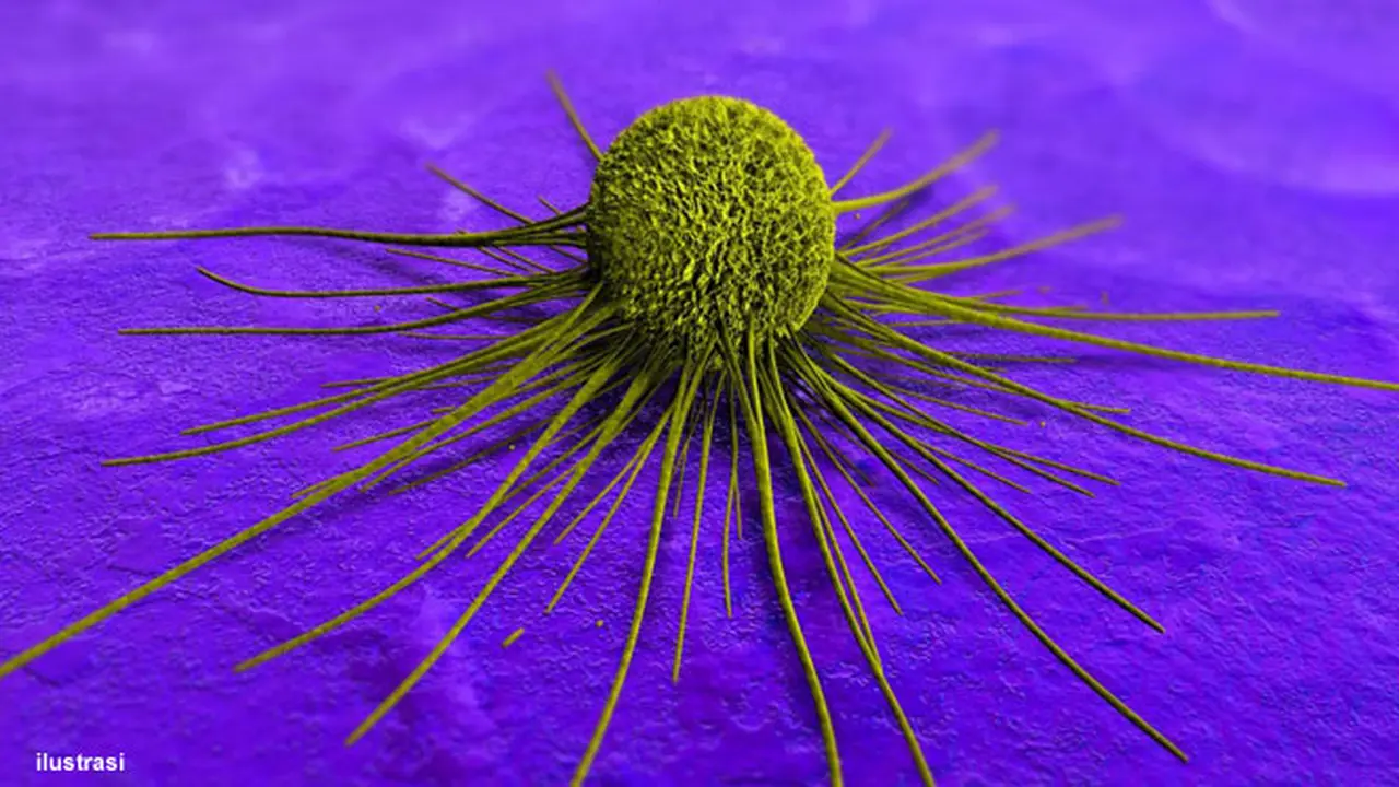 tumor-kanker-130420b.jpg