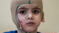 Bocah lima tahun korban konflik Palestina-Israel, Ahmad Dawabshe. (dok. Hareetz)