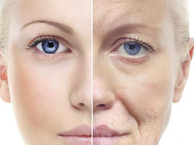 Cara Hilangkan Garis Kerutan Health Liputan6 Com