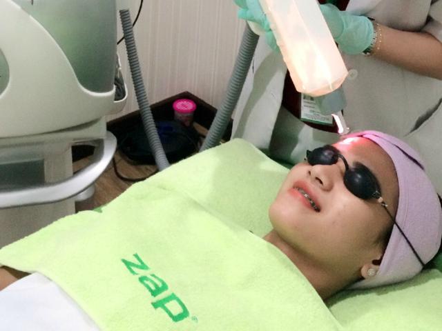 Teknologi Laser Ini Bikin Wajah Kinclong Dalam 5 Menit Fashion Beauty Liputan6 Com