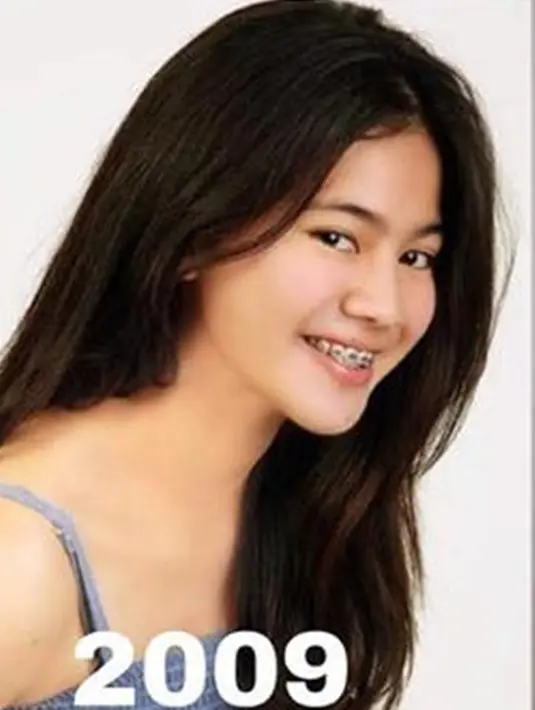 Ini dia foto masa remaja perempuan kelahiran 2 November 1994 saat 2009. Foto Feli 14 tahun lalu ini memperlihat sosoknya yang ceria. Sosoknya yang ceria ini sukses bikin warganet memiliki impresi yang bagus di dunia hiburan Tanah Air. (Liputan6.com/IG/felicyaangelista_)