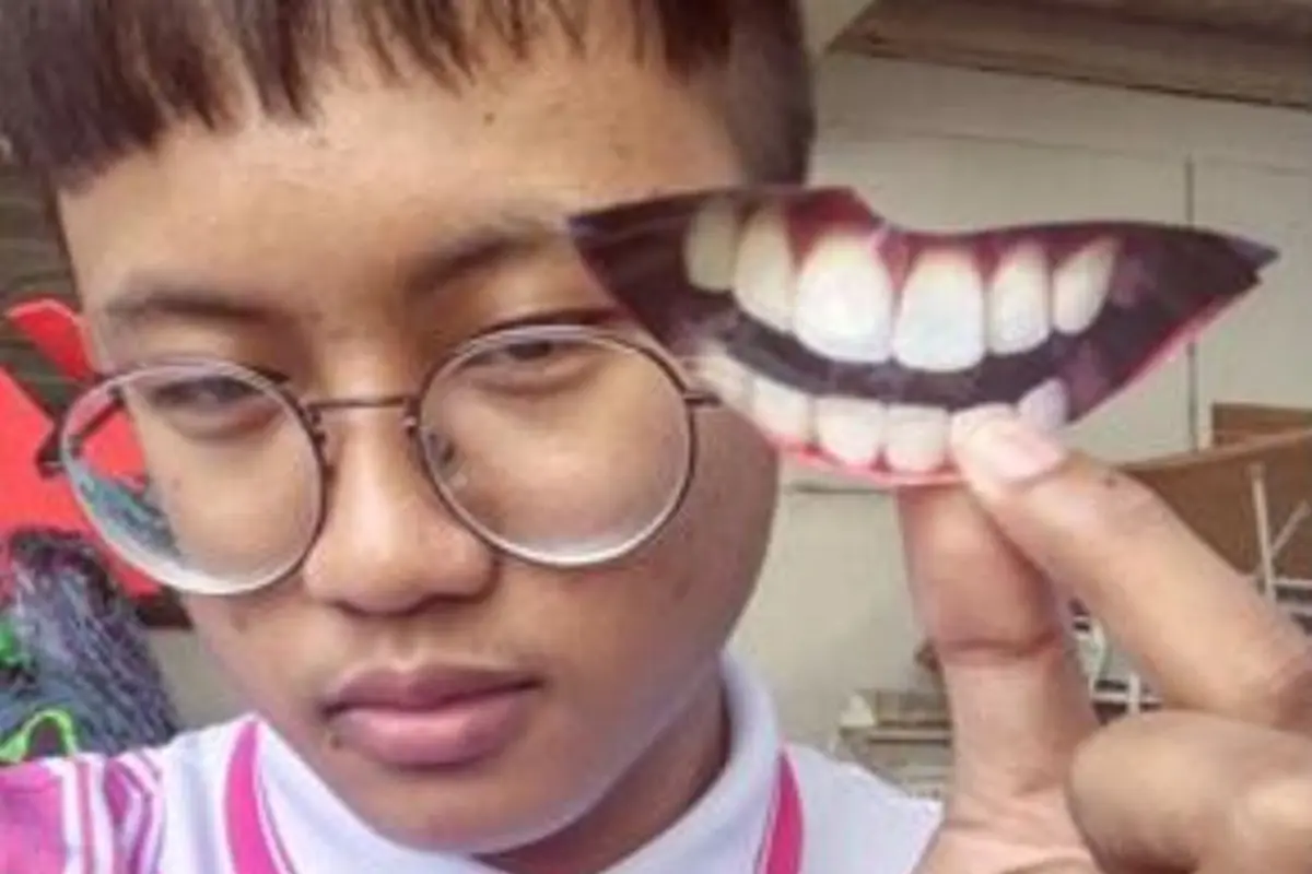 Tak Punya Uang ke Dokter Gigi? Atasi Pakai Bungkus Keripik!