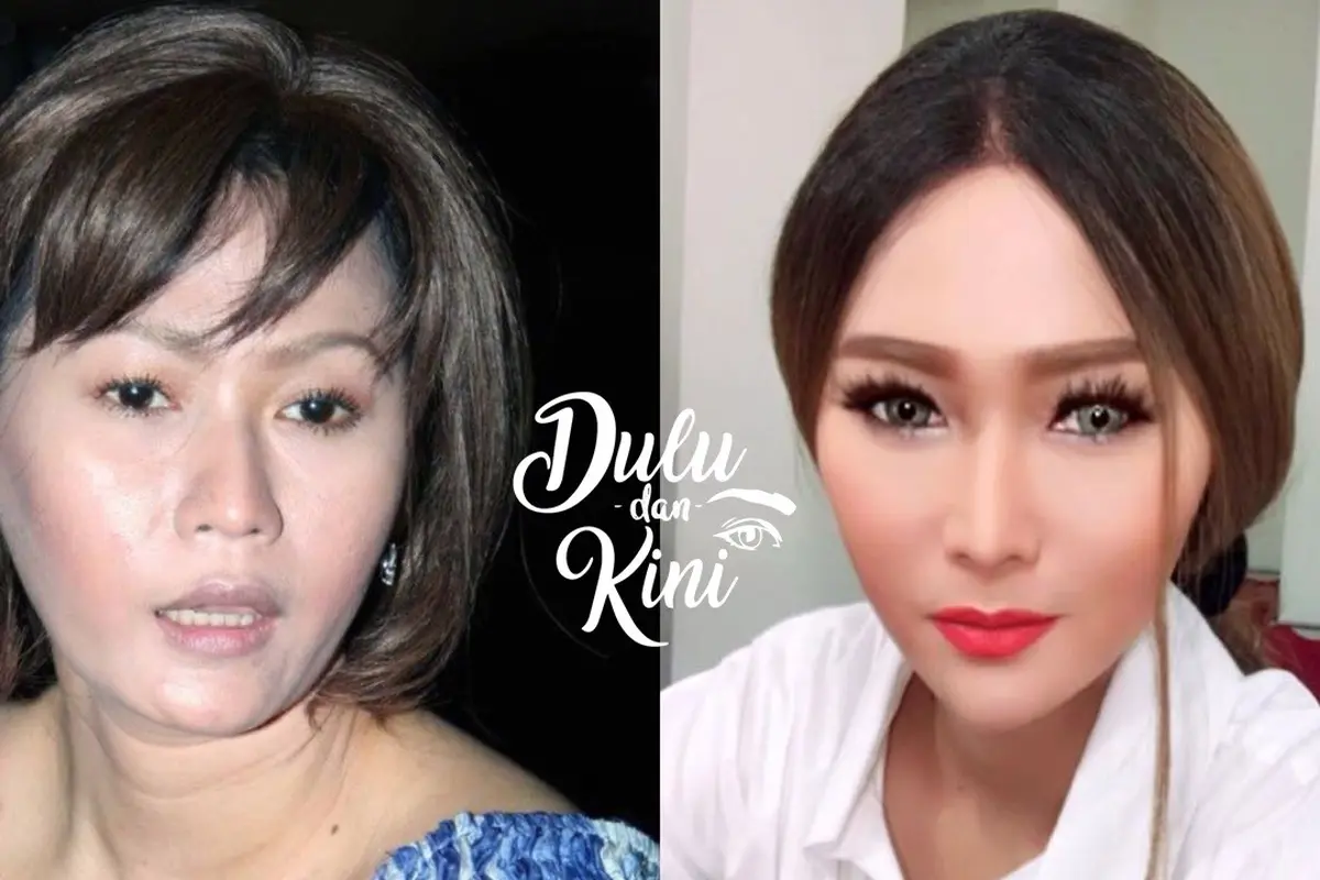 Dulu dan Kini: Transformasi Inul Daratista yang Bikin Pangling, Sekarang Super Kece!