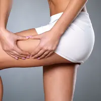 Ilustrasi Penyebab Paha Besar Credit: Freepik.com