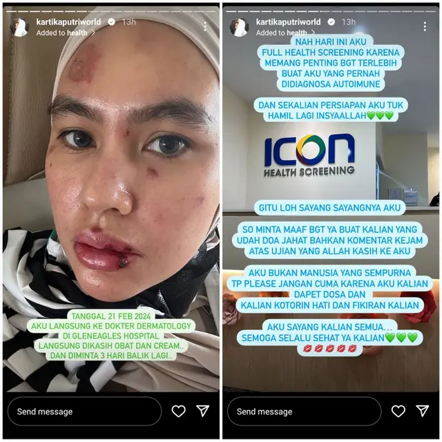 Kartika Putri