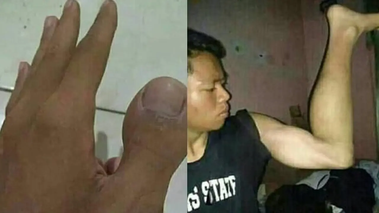 9 Potret Tangan dan Kaki Orang 'Ngebug' Ini Bikin Bingung Lihatnya