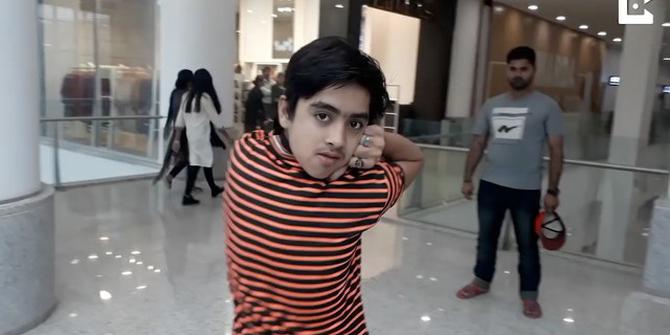 VIDEO: Wow, Kepala Bocah Bisa Berputar 180 Derajat