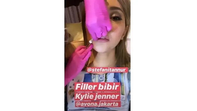 6 Potret Terbaru Lucinta Luna Setelah Filler Bibir, Sebut Mirip Kylie Jenner