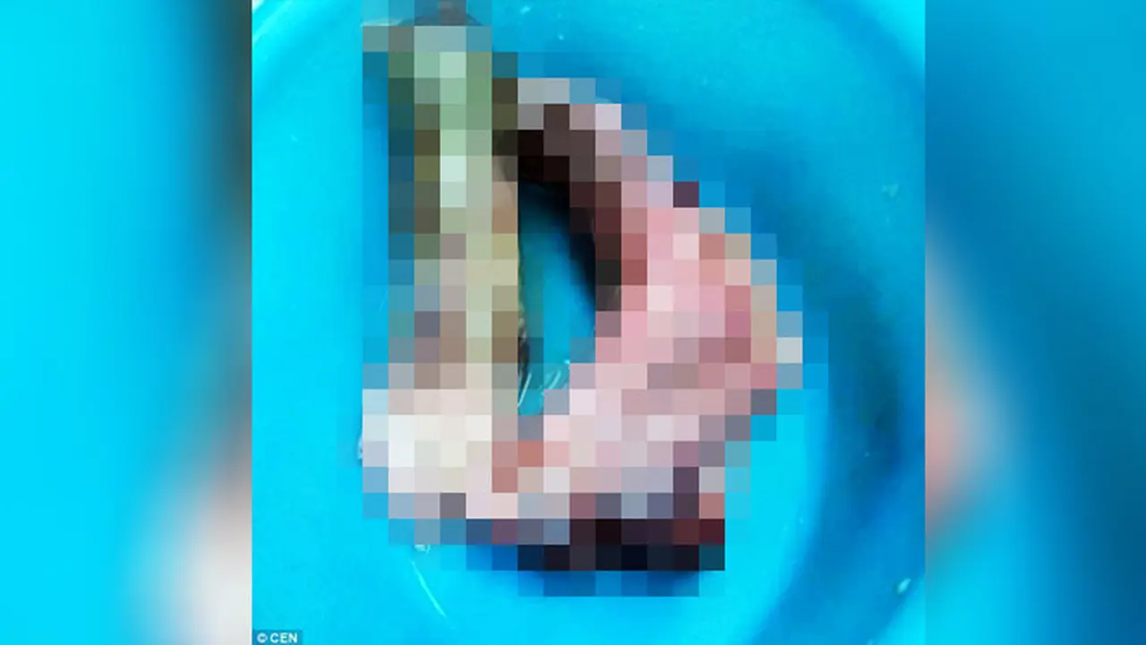 Gambar daging mirip potongan kaki manusia yang bikin heboh pengunjung restoran China di Italia. 