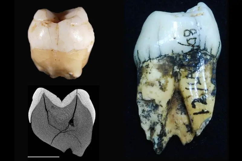 (kiri atas) Fosil gigi Homo sapiens temuan terbaru di Gua Lida Ajer, Sumatera Barat (Chris Clarkson, Kira Westaway, dkk)