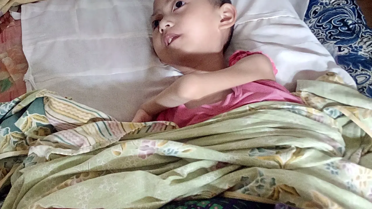 Nur Latifah Alami Gizi Buruk dan Keterbelakangan Mental