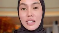 Kartika Putri kembali buka suara soal tragedi wajah melepuh yang menimpanya. Ia menyinggung adab dan akhlak dalam Islam usai diserang komentar jahat. (Foto: Dok. Instagram @kartikaputriworld)