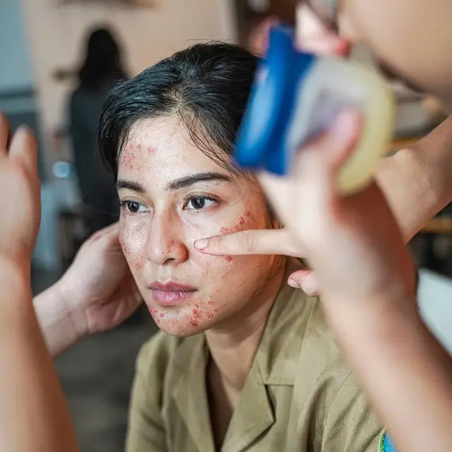Demi Film Ini 7 Potret Dian Sastro Tampil Jerawatan yang Curi Perhatian