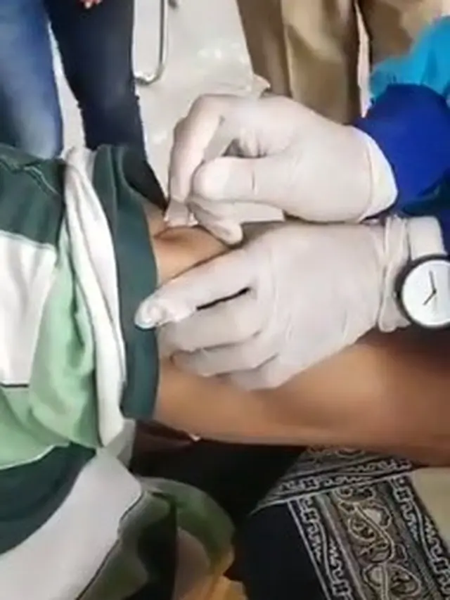 Viral Kakek Kulitnya Tak Tembus Jarum Suntik saat Divaksin, Bikin Geleng Kepala