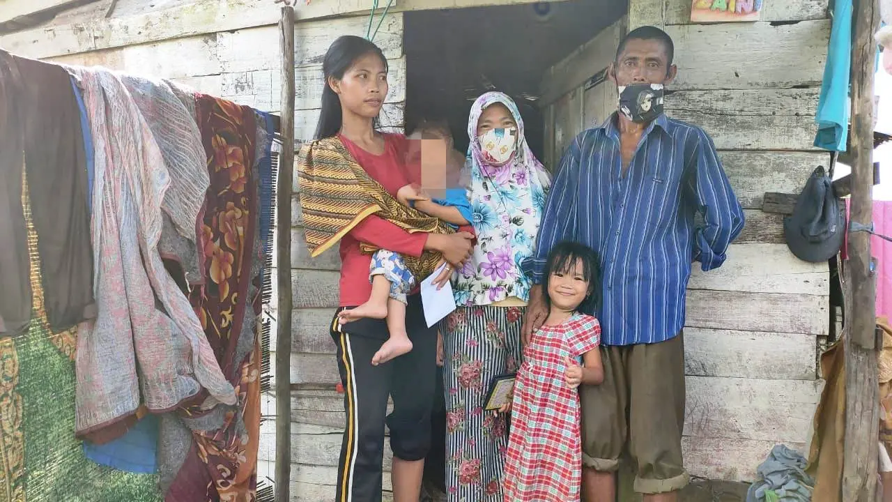Derita Bocah di Palembang, Hidup di Gubuk Rapuh dan Alami Kelainan Alat Kelamin