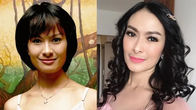 Potret Penyanyi Cantik Sebelum dan Sesudah Tanam Benang