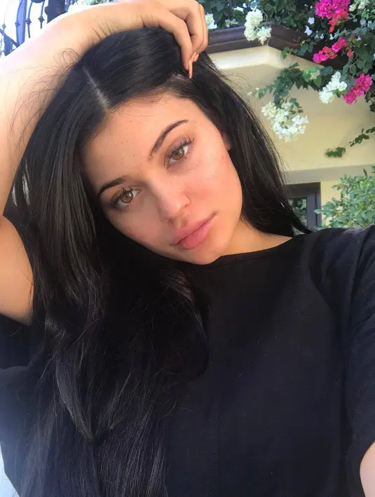 Dirinya pun ingin memberikan dukungan untuk para penggemar yang mungkin mengalami hal serupa. (instagram/kyliejenner)