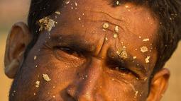 Pekerja India Mainuddin, 32 tahun, wajahnya terkena tanah saat bekerja di tempat pembakaran batu bata di pinggiran Gauhati, India (22/11). Sebagian besar buruh di sini mendapatkan Rupee 120 (kurang dari 2 Dolar) per hari. (AP Photo/Anupam Nath)