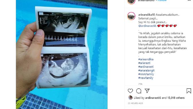 [Foto: Instgaram Arie Dwi Andika]