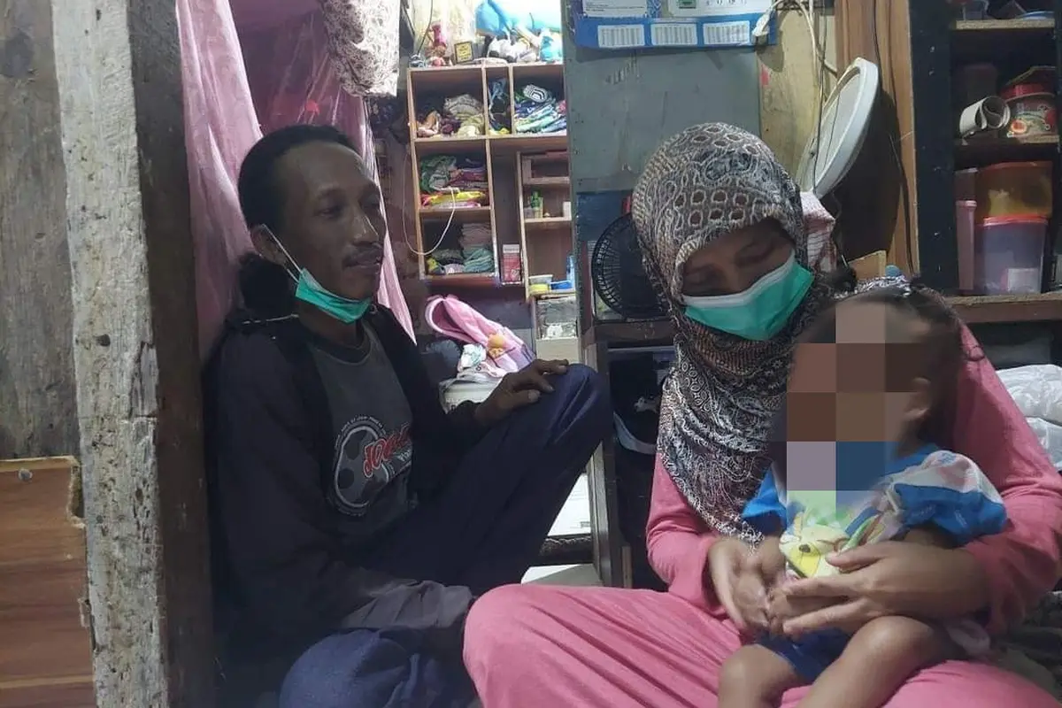 Laila Fitria, bayi stunting berusia 23 bulan yang menderita kelamin ganda (Liputan6.com/Istimewa)