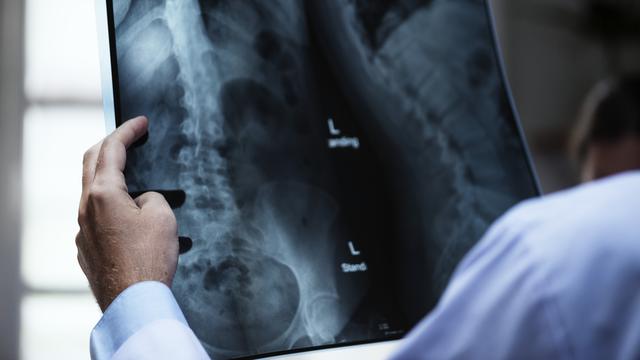 Gangguan tulang diakibatkan pada jelaskan infeksi yang oleh makalah gangguan