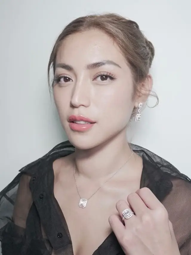 6 Potret Terbaru Jessica Iskandar, Leher Bengkak Akibat Sakit Tiroid